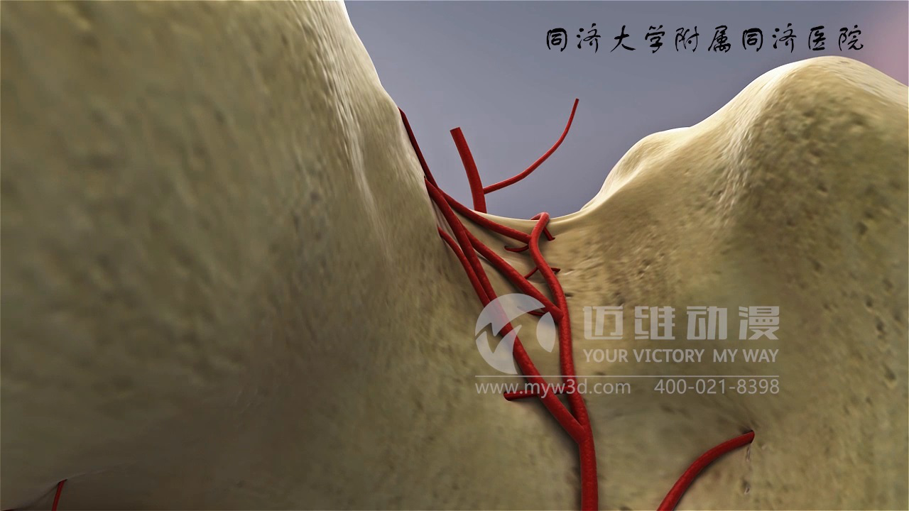 醫(yī)學(xué)仿真三維動(dòng)畫演示