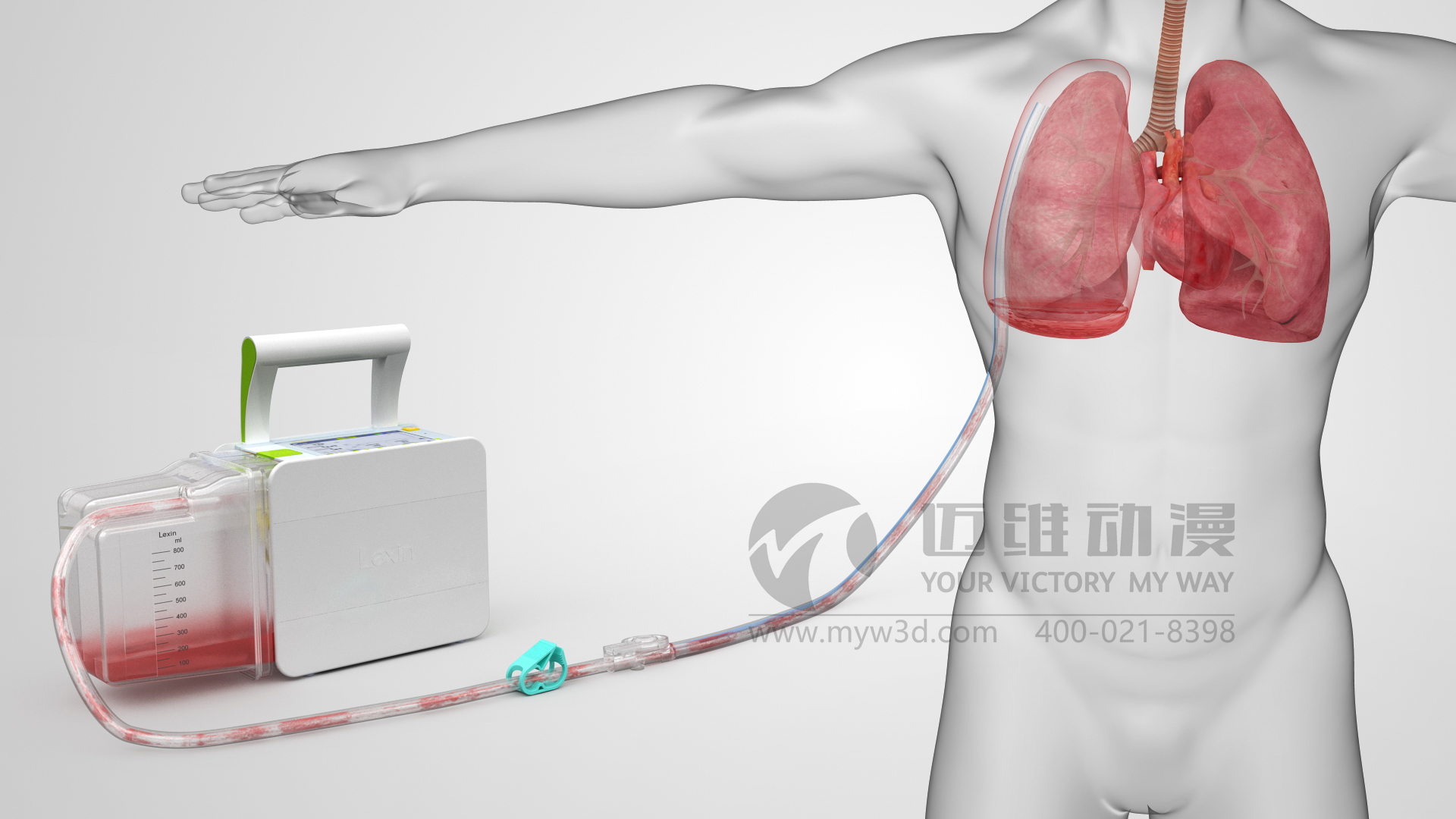 醫(yī)療器械動畫.jpg 醫(yī)療器械動畫.jpg