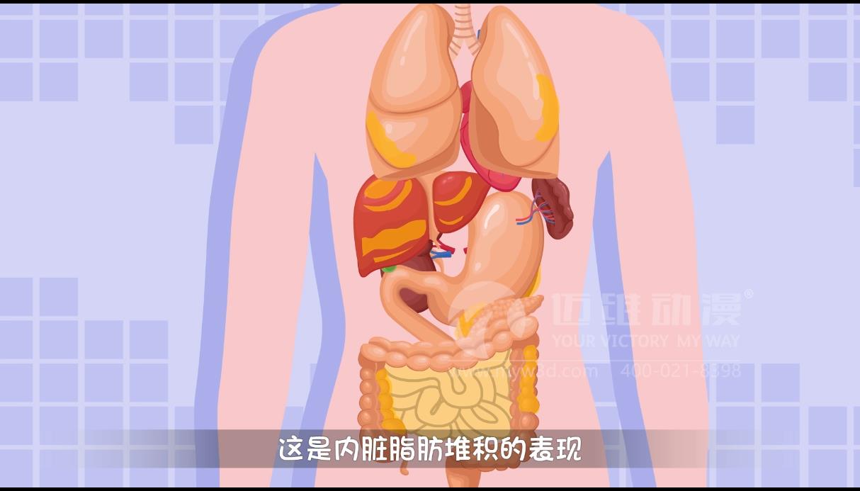 MG動(dòng)畫(huà)，邁維動(dòng)漫.jpg
