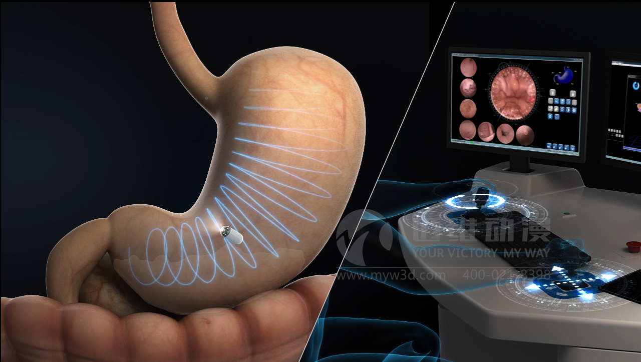 醫(yī)學(xué)醫(yī)療三維動(dòng)畫在醫(yī)療行業(yè)中的應(yīng)用及優(yōu)勢(shì)(圖1) 醫(yī)學(xué)醫(yī)療三維動(dòng)畫在醫(yī)療行業(yè)中的應(yīng)用及優(yōu)勢(shì)(圖1)