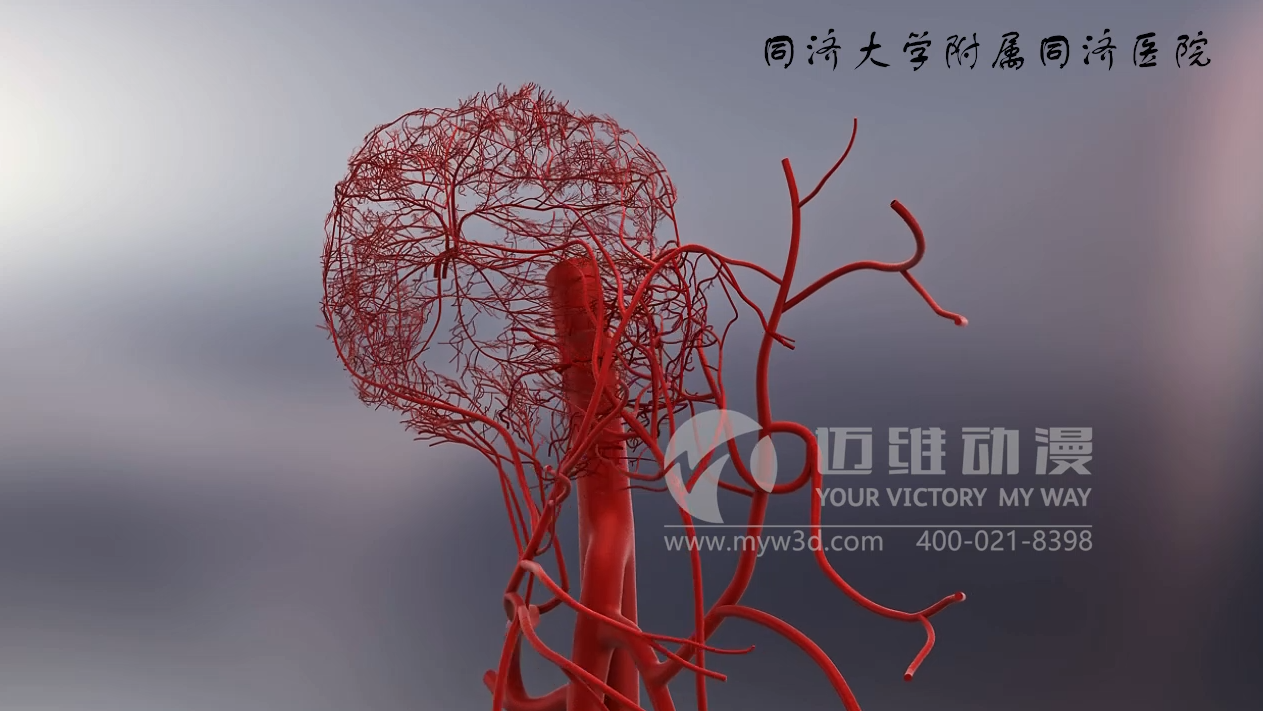 醫(yī)療三維動畫制作.png 醫(yī)療三維動畫制作.png