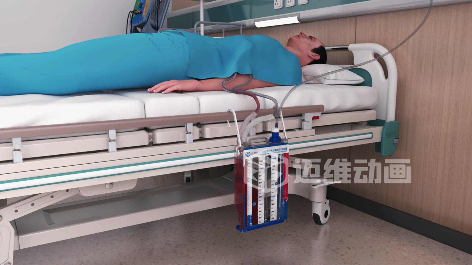 水封胸腔引流裝置三維動畫 水封胸腔引流裝置三維動畫